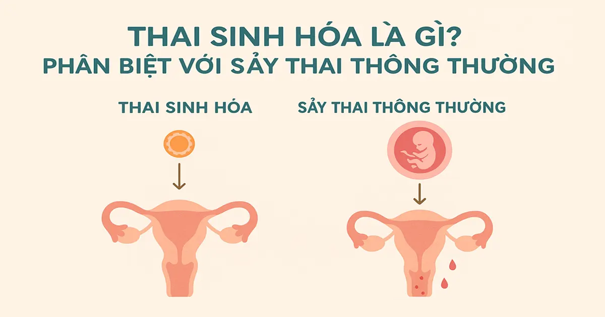 Thai sinh hóa là gì? Phân biệt với sảy thai thông thường