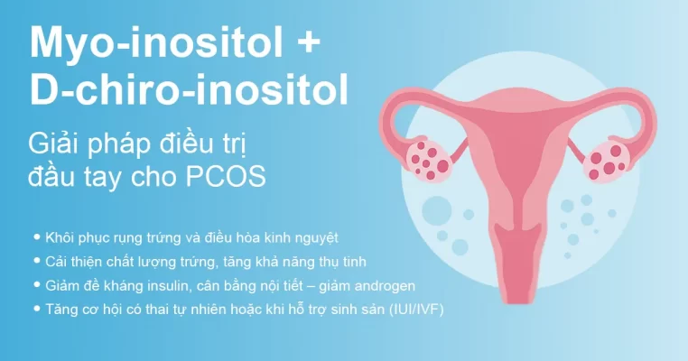 Sự kết hợp của Myo-inositol và D-chiro-inositol: Giải pháp điều trị đầu tay cho PCOS
